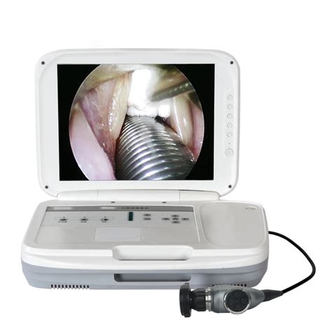 This camera is connected to an eyepiece or a monitor for viewing. . Cheapest endoscopy in the philippines